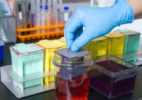 Webinar: H&E Staining: Science and Troubleshooting