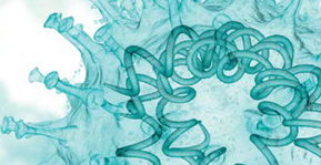 Universal Coronavirus Vaccine