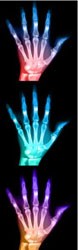 hand-x-ray