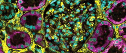 Studying SHH in Kidney Tissue Studying SHH in Kidney Tissue