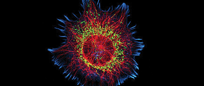 The Cytoskeleton of a Neuroblastoma Cell The Cytoskeleton of a Neuroblastoma Cell