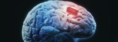 biology-archive-the-future-medical-implant-1761