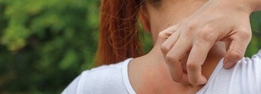 life-sciences-archive-scratching-surface-severe-itching-1761