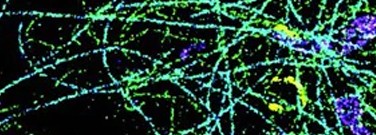 stem-archive-first-true-color-super-resolution-microscopy-1761