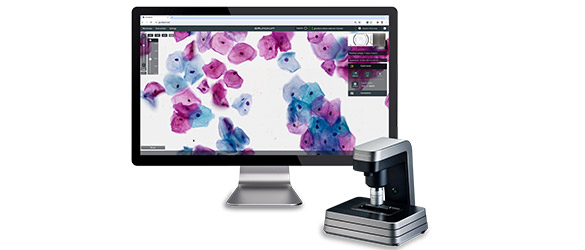 Grundium Ocus™ Digital Microscope Slide Scanners Grundium Ocus™ Digital Microscope Slide Scanners