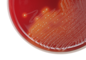 Acute Pharyngitis: Advances in Pathogen Identification & Diagnosis Acute Pharyngitis: Advances in Pathogen Identification & Diagnosis