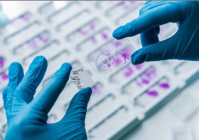 Join our slide staining webinar and learn how to find, fix, and avoid common workflow errors. Register now. Join our slide staining webinar and learn how to find, fix, and avoid common workflow errors. Register now.