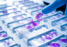 Importance of Microscope Slides and Coverglasses in the Lab Importance of Microscope Slides and Coverglasses in the Lab