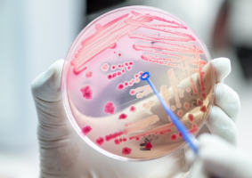antimicrobial-detection-main-22-2562 antimicrobial-detection-main-22-2562