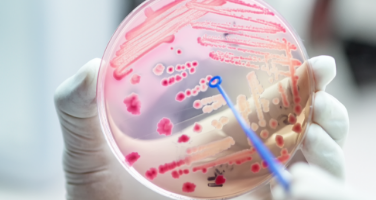 Using Clinical Breakpoints to Improve Antimicrobial Resistance Detection Using Clinical Breakpoints to Improve Antimicrobial Resistance Detection