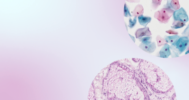 Using Telepathology to Advance Patient Care and Lab Workflows Using Telepathology to Advance Patient Care and Lab Workflows