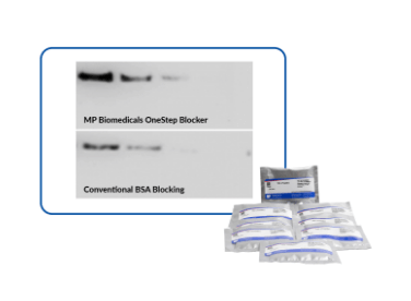 Blotting & Imaging Blotting & Imaging